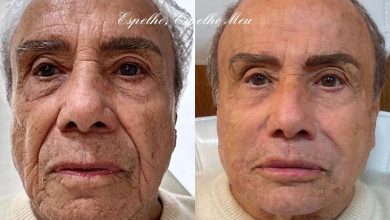 Após polêmica com harmonização facial de Stênio Garcia, Rodrigo César explica procedimentos estéticos na terceira idade