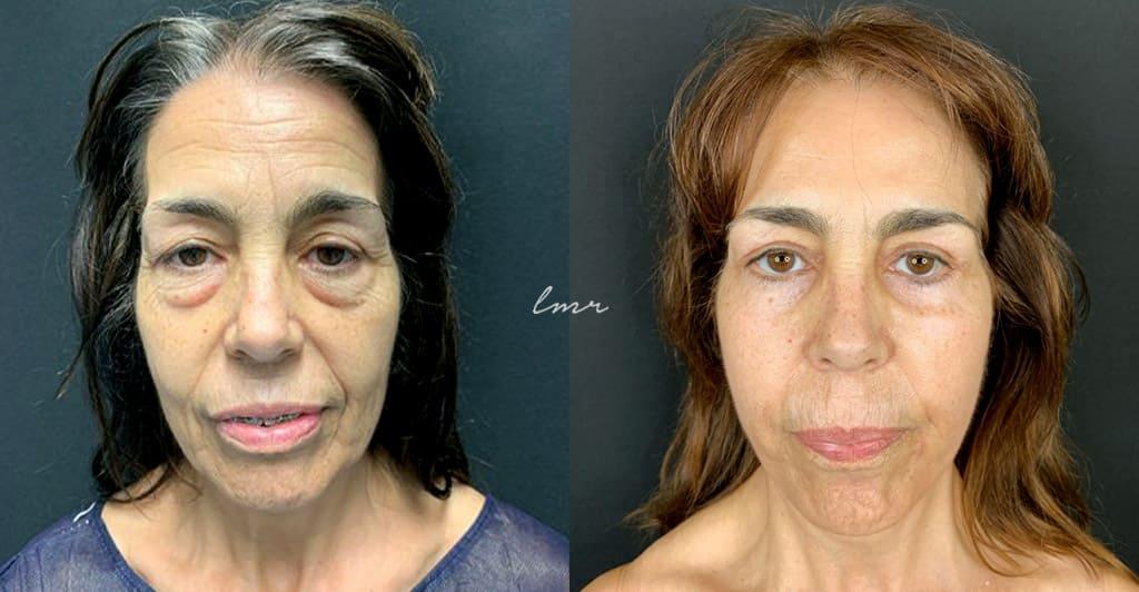 Imagem: Dra. Luísa Magalhães Ramos