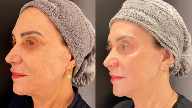 Imagem: Dr. Lucas Miranda