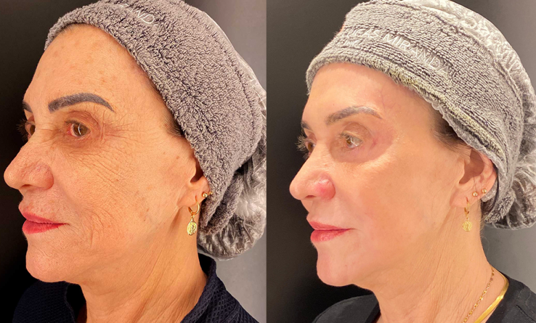 Imagem: Dr. Lucas Miranda