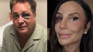 Aparições recentes reacendem especulações sobre o chamado “Clube do Olho Roxo”, mas especialistas apontam explicações comuns